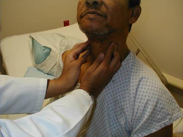 목에 림프관염 : 원인, 증상 및 치료